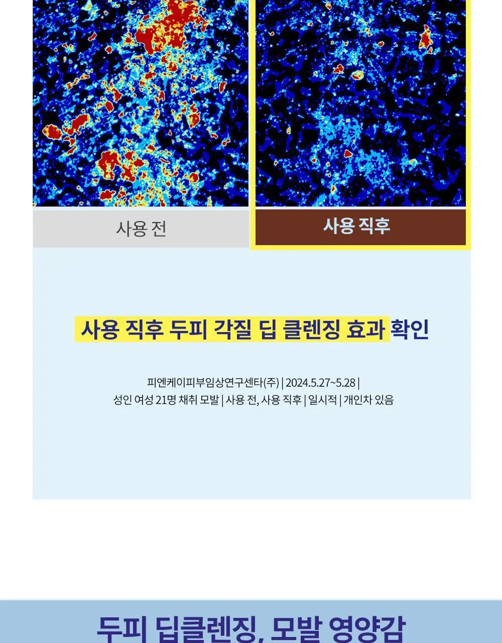 [단백질 2배]힐링버드 리바이브 단백질 샴푸 500ml 상세페이지 21